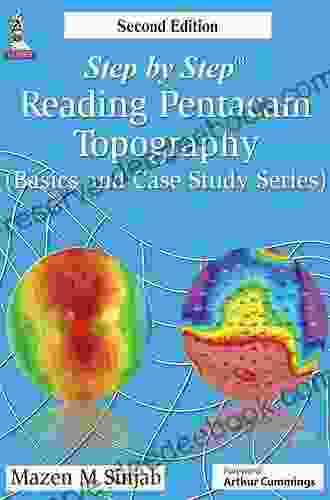 Step By Step Reading Pentacam Topography (Basics And Case Study Series)